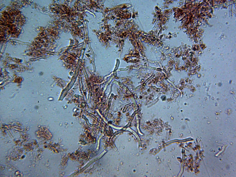 Abortiporus biennis 12 - Hifas x 400